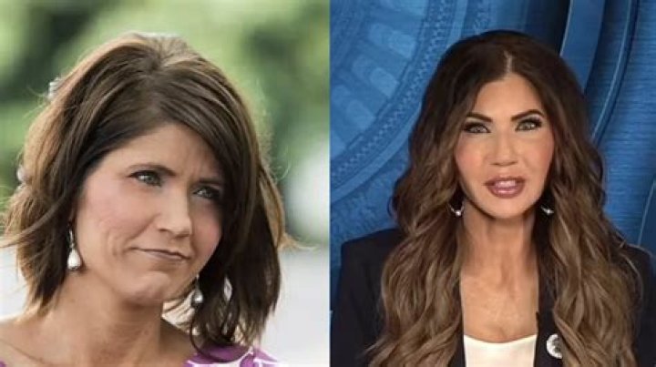 Governor Kristi Noem's Journey With Plastic Surgery: Transformation Uncovered