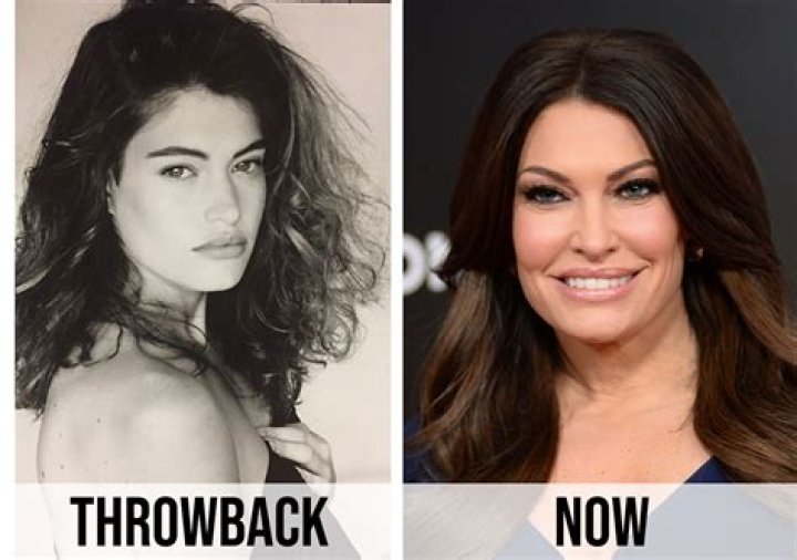 Kimberly's Transformation: Before And After Surgery