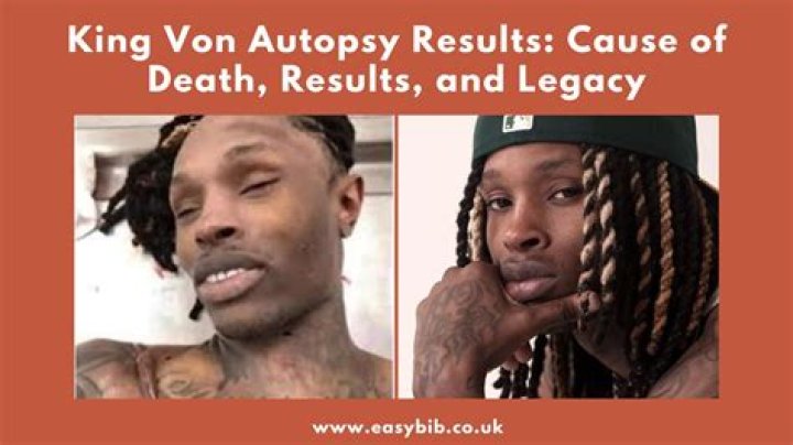 Unraveling The Tragedy: King Von Autopsy Cause Of Death